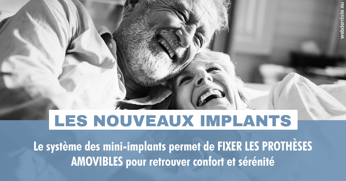 https://www.dentisteivry.fr/Les nouveaux implants 2