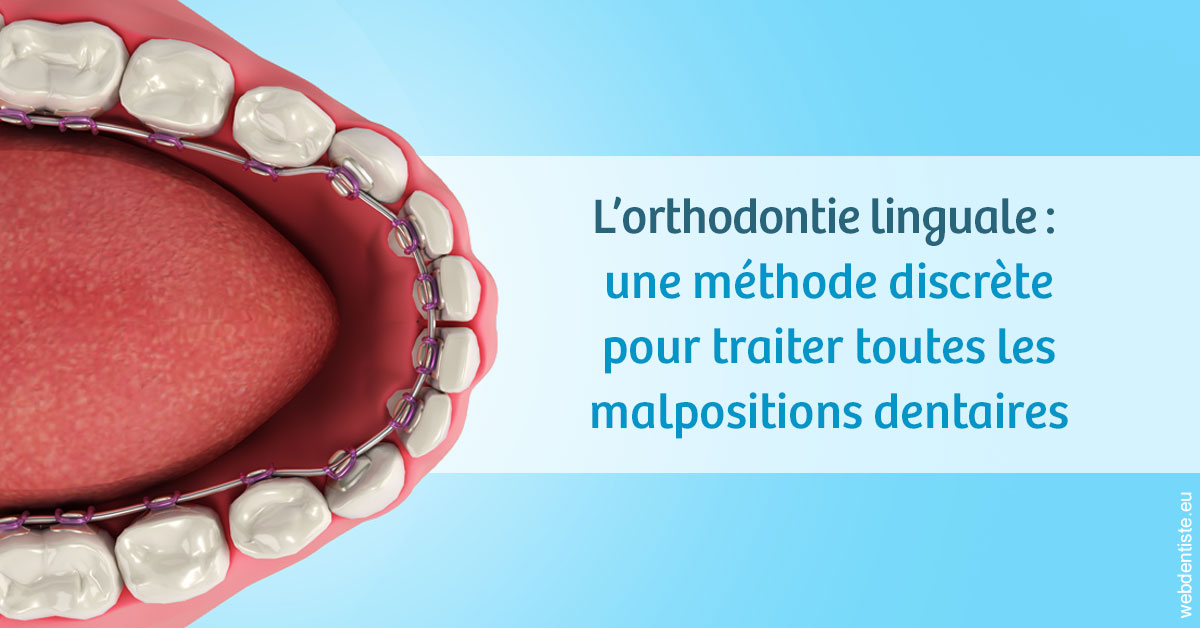 https://www.dentisteivry.fr/L'orthodontie linguale 1