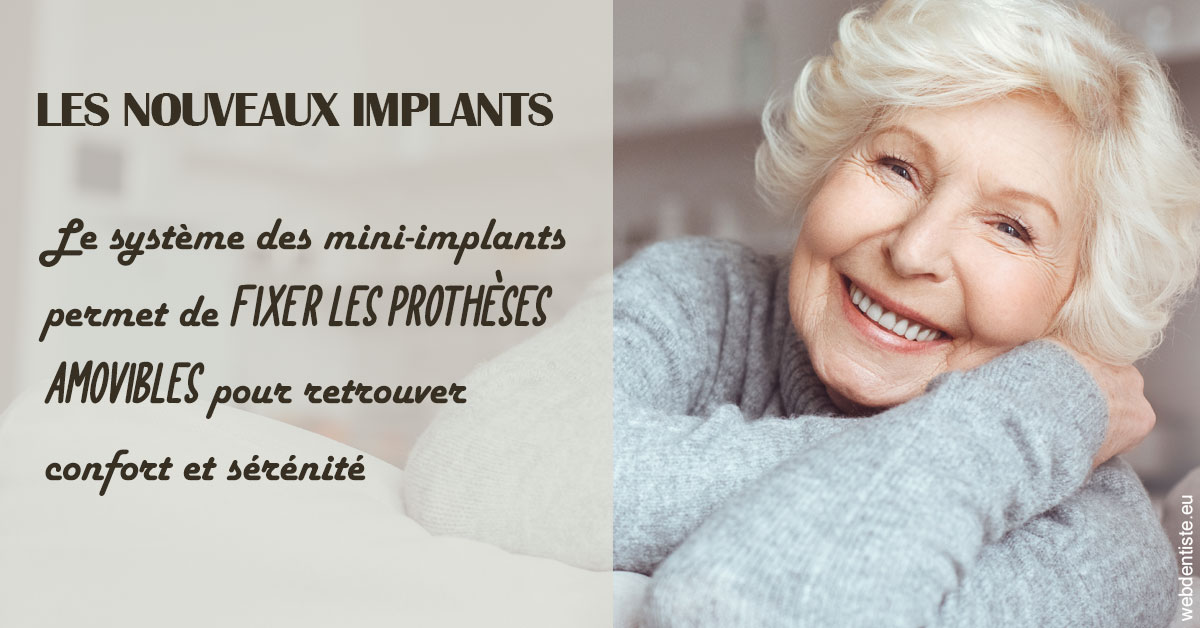 https://www.dentisteivry.fr/Les nouveaux implants 1