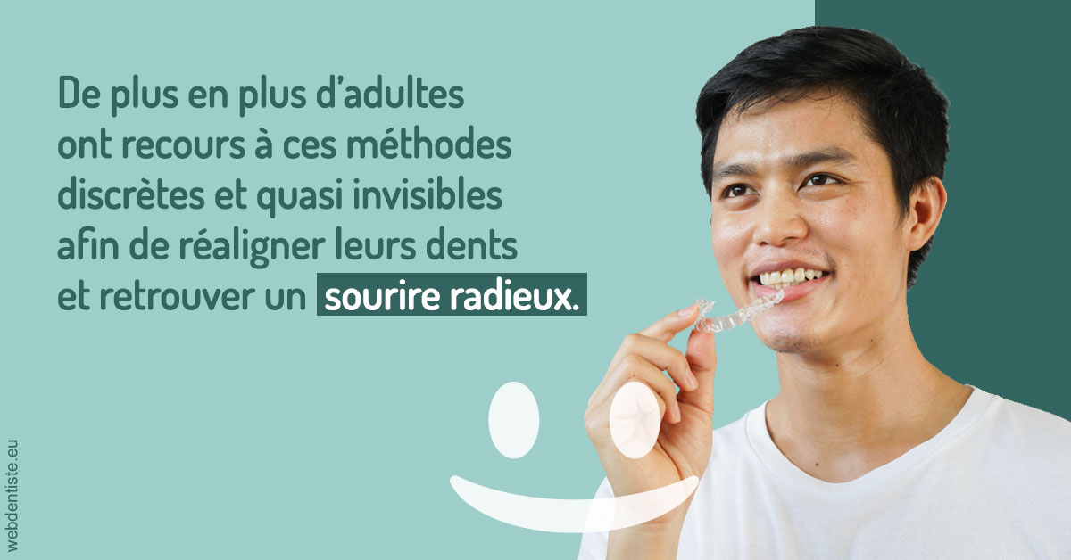 https://www.dentisteivry.fr/Gouttières sourire radieux 2