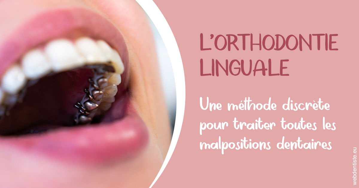 https://www.dentisteivry.fr/L'orthodontie linguale 2