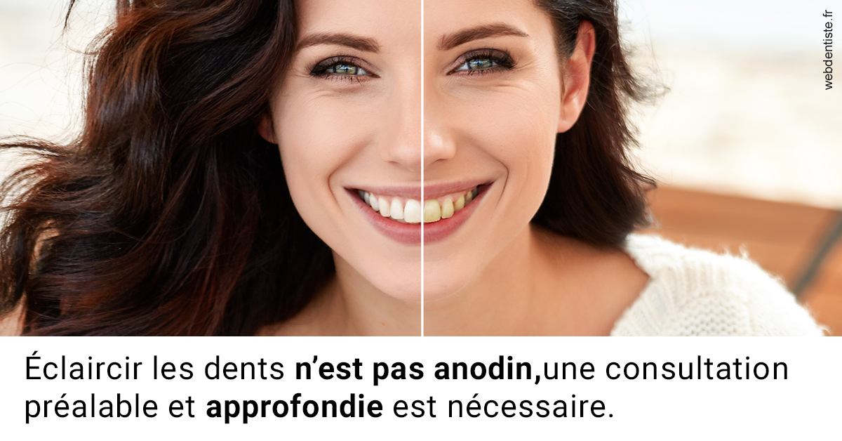 https://www.dentisteivry.fr/Le blanchiment 2