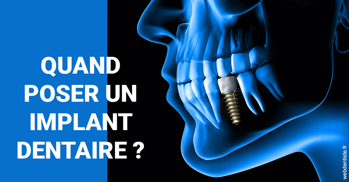 https://www.dentisteivry.fr/Les implants 1