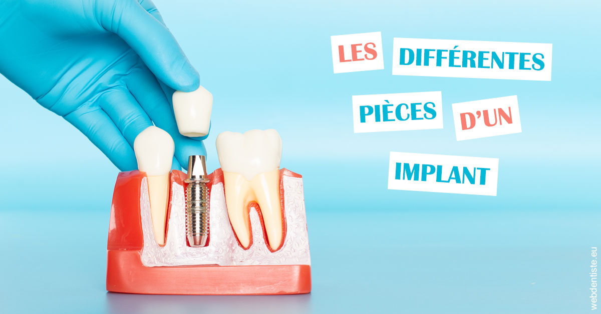 https://www.dentisteivry.fr/Les différentes pièces d’un implant 2