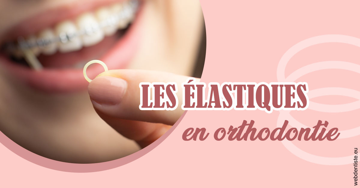 https://www.dentisteivry.fr/Elastiques orthodontie 1