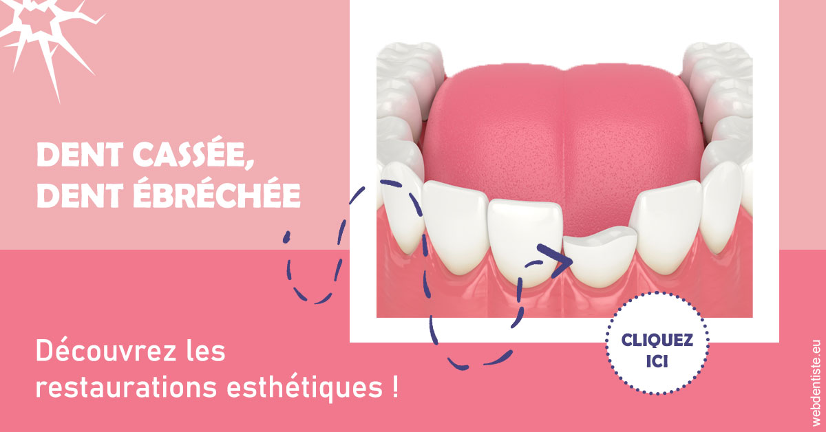 https://www.dentisteivry.fr/Dent cassée ébréchée 1