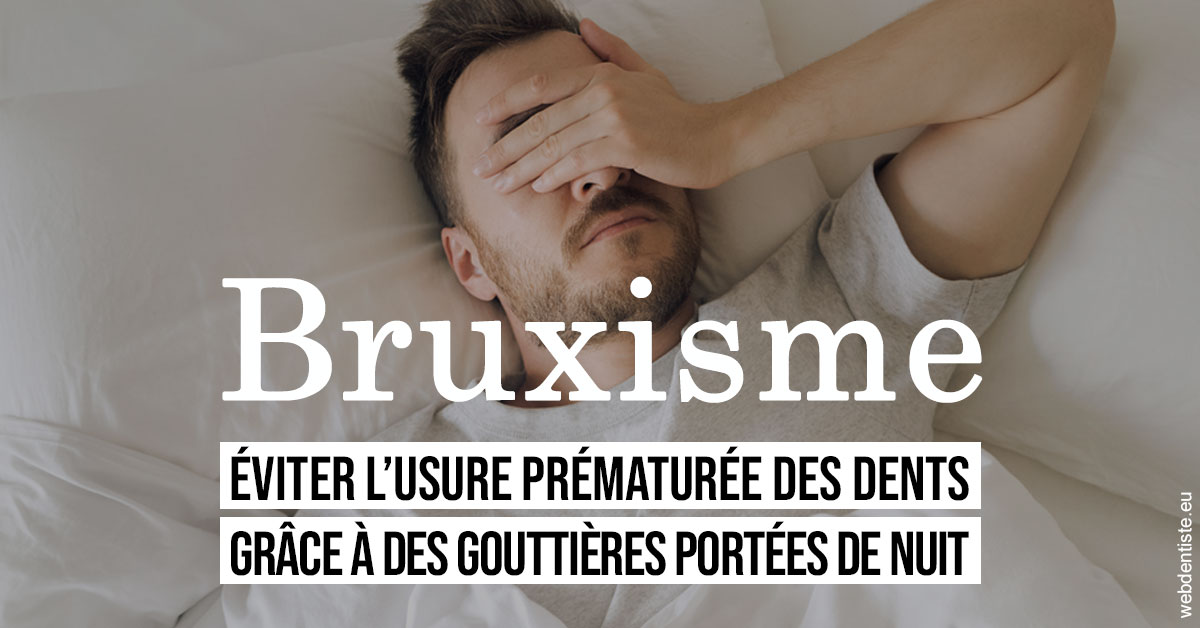 https://www.dentisteivry.fr/Bruxisme 1