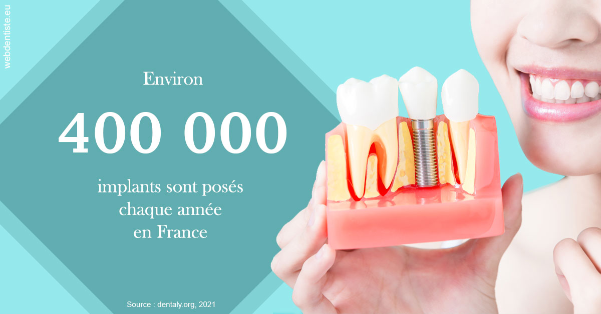 https://www.dentisteivry.fr/Pose d'implants en France 2