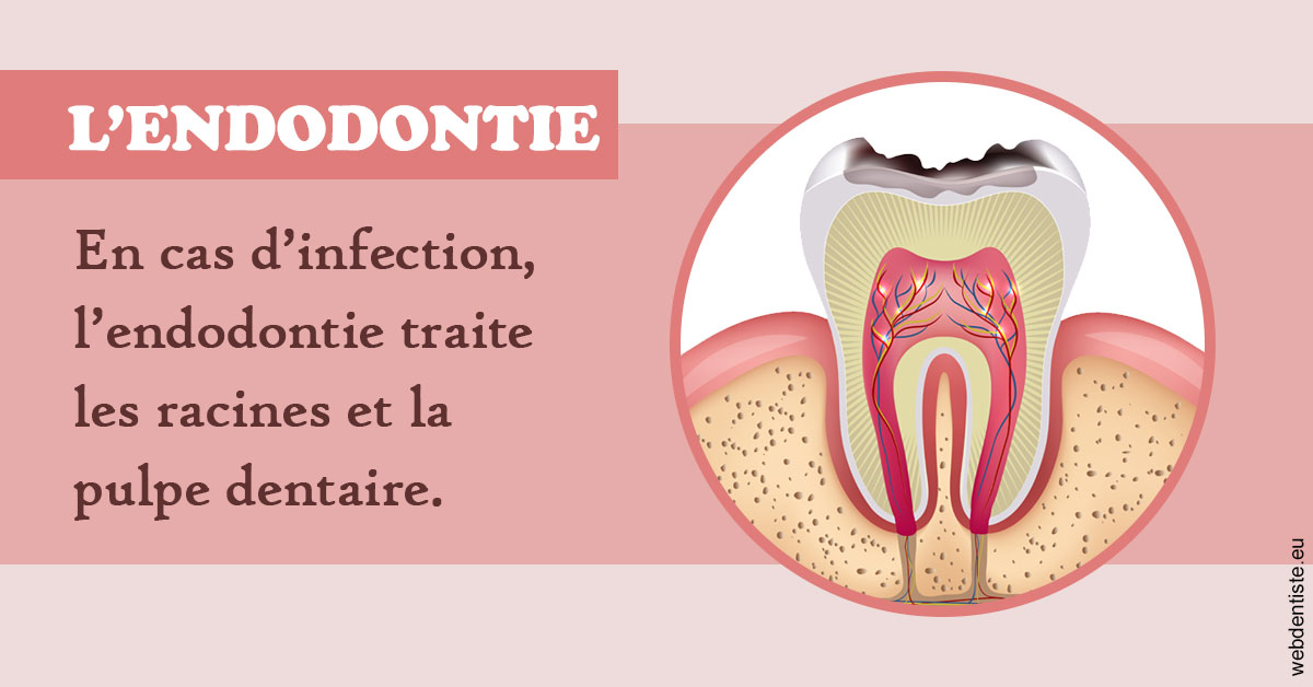 https://www.dentisteivry.fr/L'endodontie 2