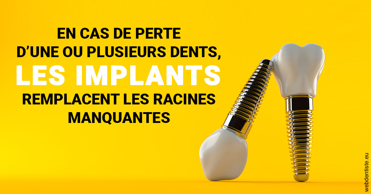 https://www.dentisteivry.fr/Les implants 2