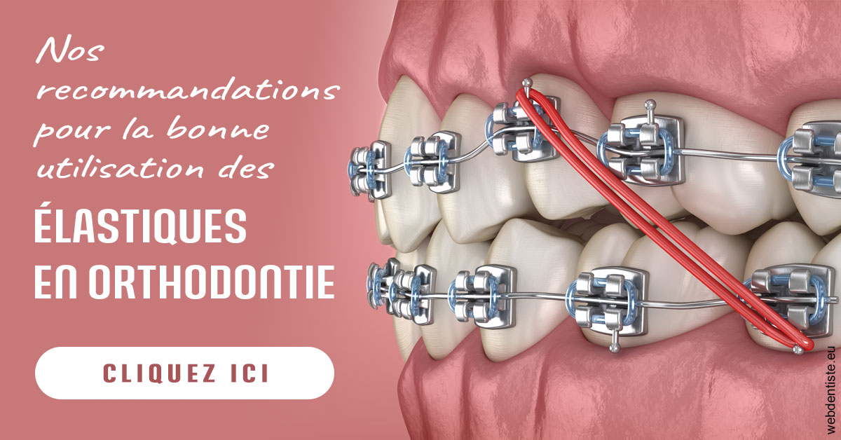 https://www.dentisteivry.fr/Elastiques orthodontie 2