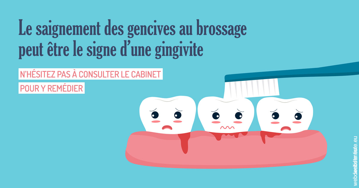https://www.dentisteivry.fr/2023 T4 - Saignement des gencives 02
